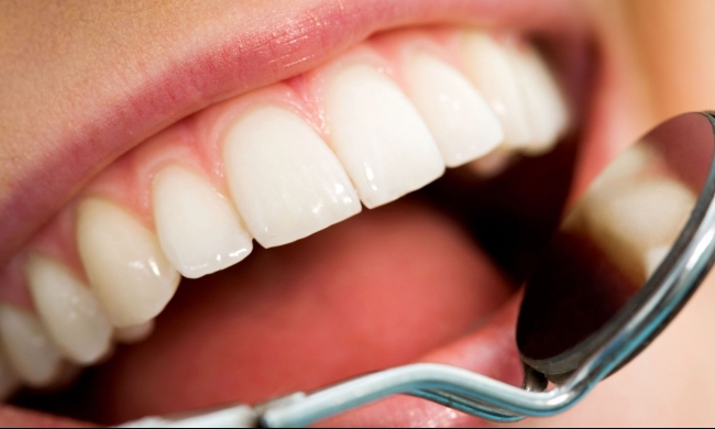 ابتكار علاج جديد لعلاج تسوس الاسنان بدون الحاجة إلى الحشو