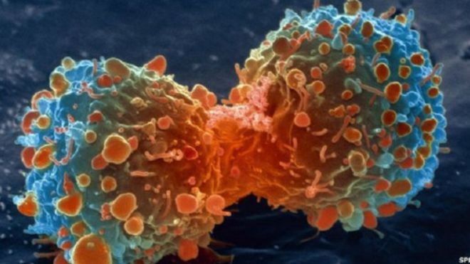 أحدث الأبحاث في التعرف على أنواع السرطان الوراثي بالمملكة