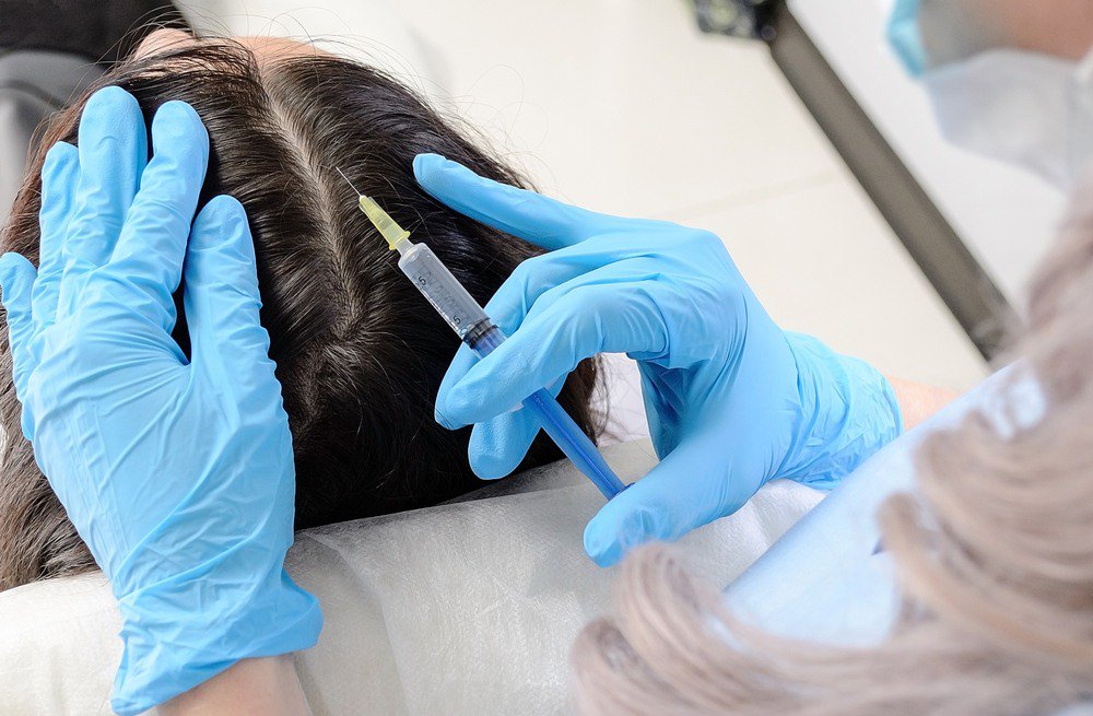 استخدام كولاجين في علاج تساقط الشعر