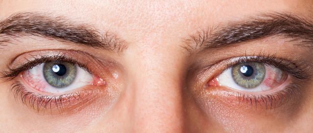 افرازات العين الدالة على وجود أمراض