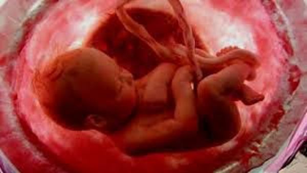 حقيقة الخلايا الجذعية المسئولة عن الإجهاض المتكرر