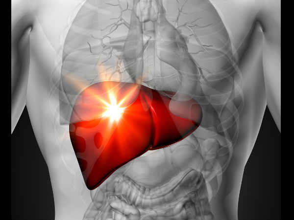 علامات الإصابة بمرض الكبد الدهني