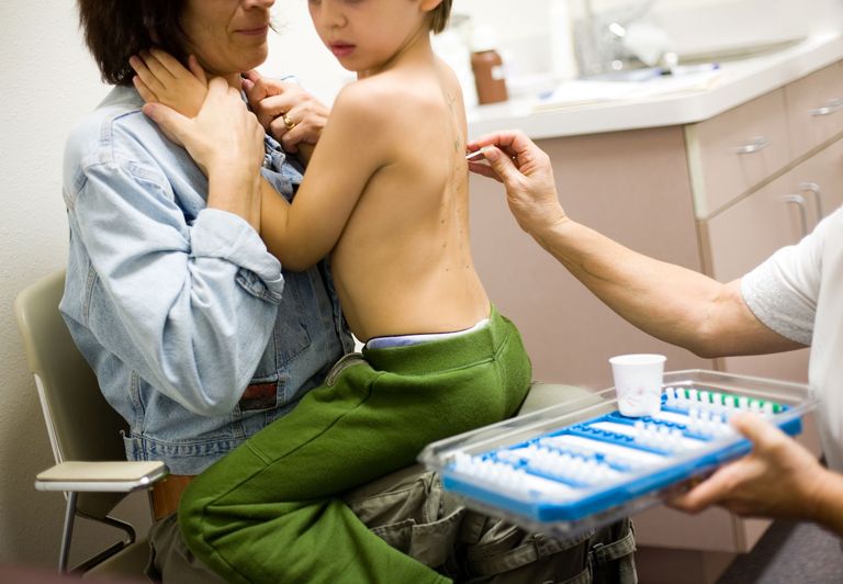 هل العلاج المناعي للحساسية آمن على الأطفال ؟
