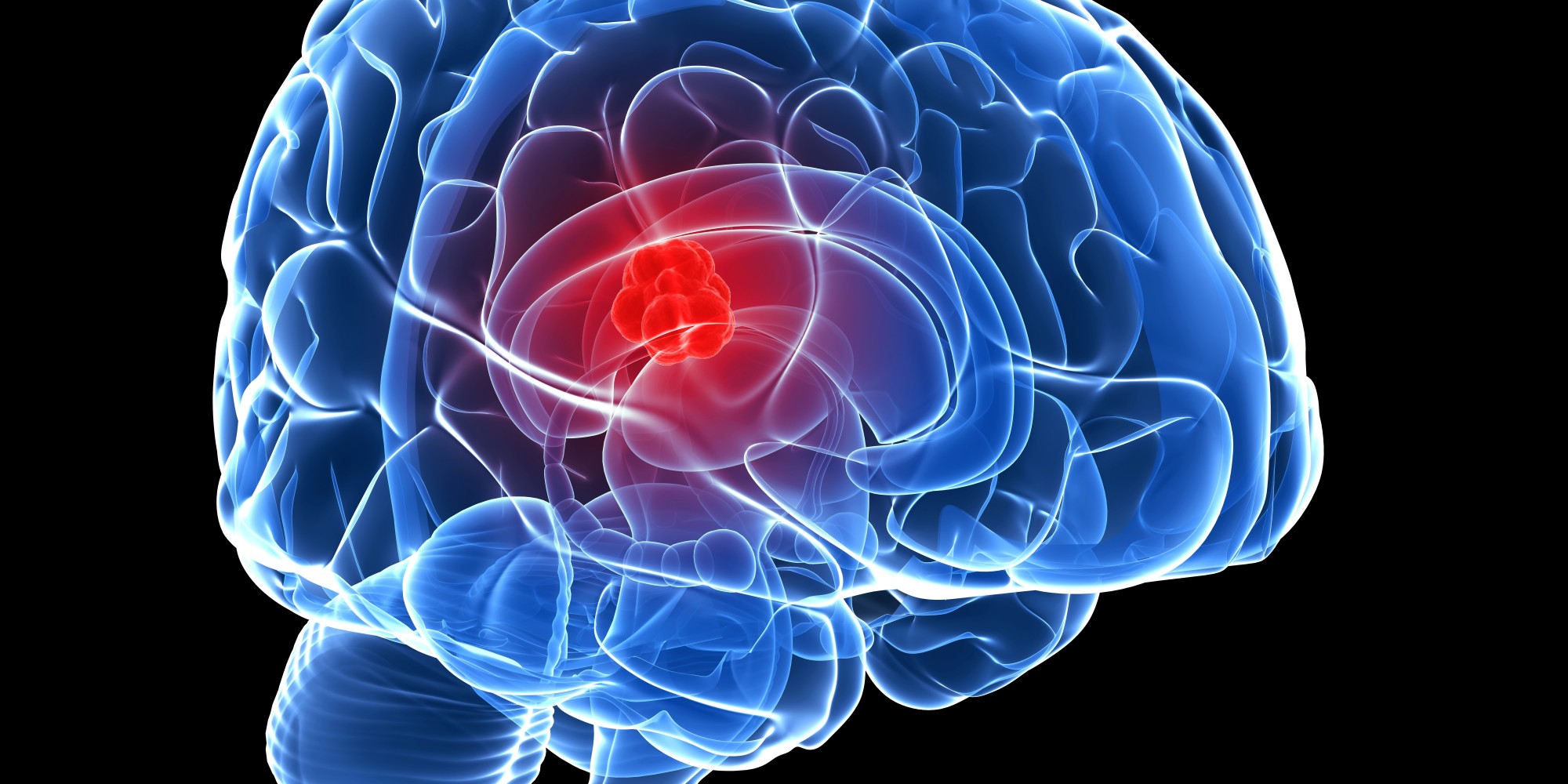حقن الخلايا المناعية في المخ يشفي من اورام المخ