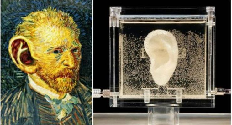 لماذا قطع الرسام الهولندي المعروف فان غوخ أذنه ؟