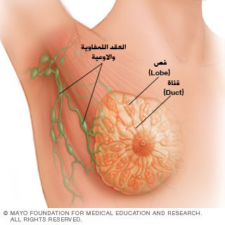 مراحل تطور سرطان الثدي بالصور