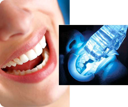 اضرار تنظيف الاسنان بالليزر والبديل الصحي