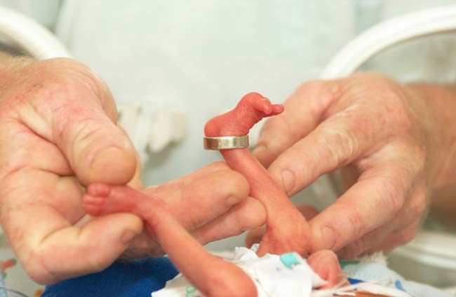 التعرض للملوثات الهوائية يرفع من خطر الولادة المبكرة