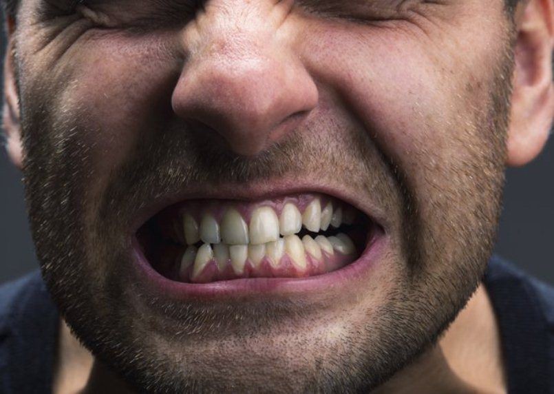 التوتر والإجهاد وصحة الأسنان