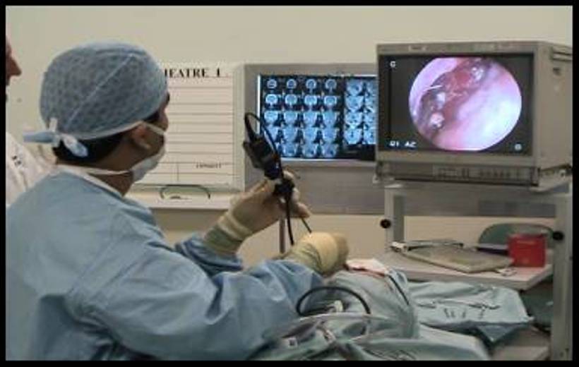 الجراحة التنظيرية Endoscopic Surgery