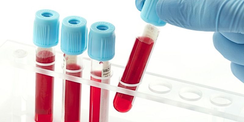 تطوير اختبار الدم للتمييز بين العدوى الفيروسية والجرثومية