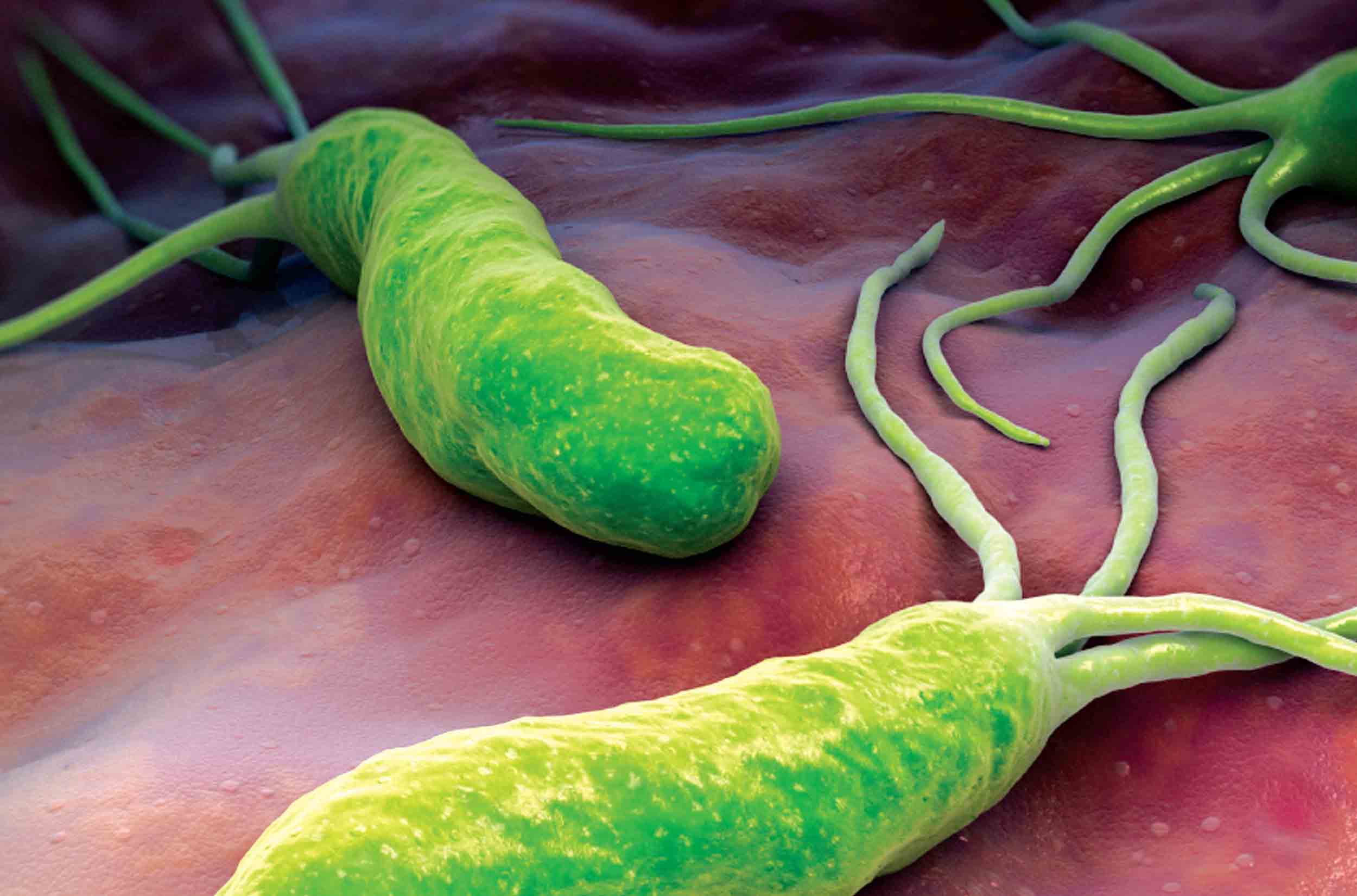 تعرف على جرثومة الملوية البوابية ” Helicobacter pylori “