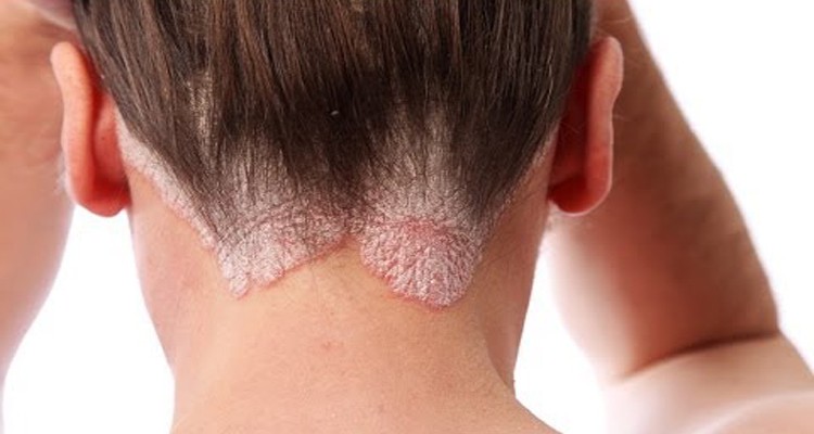 خمسة مشاكل شائعة للجلد