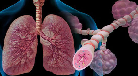 داء الانسداد الرئوي المزمن( COPD ).. الاسباب و العلاج