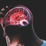 دراسة كندية حديثة ” ارتجاج الدماغ ” يؤدي الى الأنتحار
