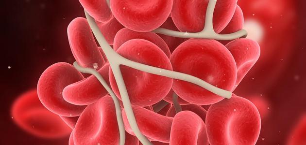 دهن الافوكادو وعلاج سرطان الدم “اللوكيميا”