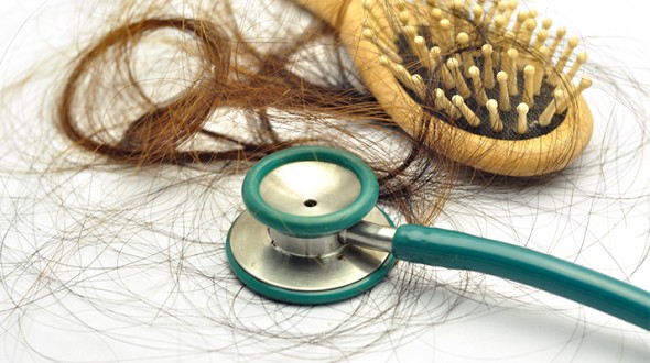 علاقة تساقط الشعر بالإجهاد و التغيرات الهرمونية