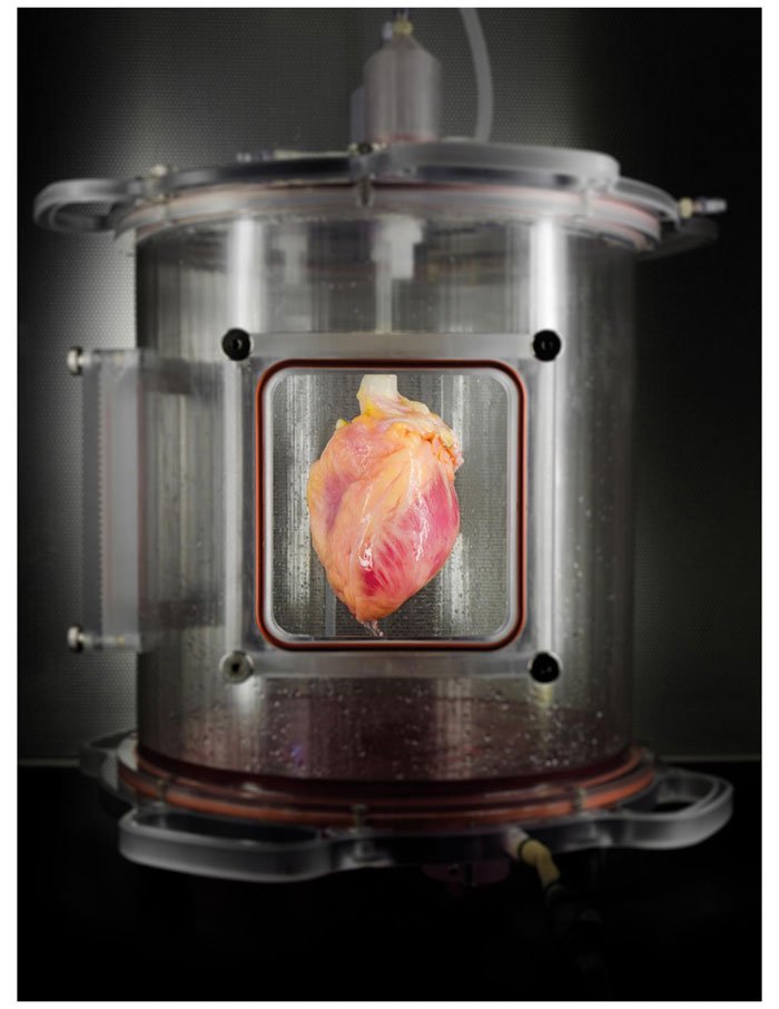 كيفية استخدام الخلايا الجذعية في علاج أمراض القلب