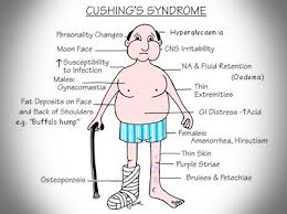 كل ماتود معرفته عن متلازمة كوشينغ cushing’s Syndrome