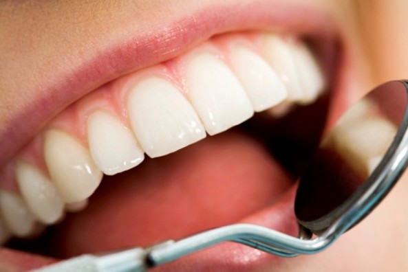 اسباب اصفرار الاسنان و طرق العلاج