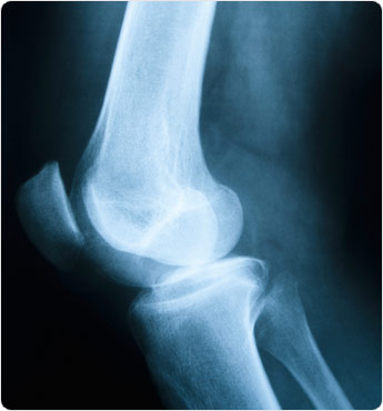 اسباب وعلاج ألم الركبة