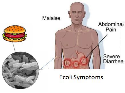 اعراض بكتيريا القولون