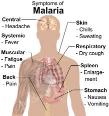 طرق علاج الملاريا